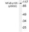 Nuclear Factor Kappa B Subunit 1 antibody, LS-C178038, Lifespan Biosciences, Western Blot image 