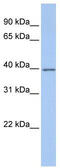 G Protein Subunit Alpha I2 antibody, TA335037, Origene, Western Blot image 