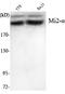 Chromodomain Helicase DNA Binding Protein 3 antibody, A03200, Boster Biological Technology, Western Blot image 