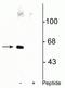 Apoptosis Antagonizing Transcription Factor antibody, P03945, Boster Biological Technology, Western Blot image 
