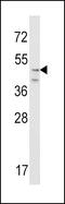 Corticotropin Releasing Hormone Receptor 2 antibody, MBS9214752, MyBioSource, Western Blot image 