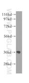 Calponin 3 antibody, 11509-1-AP, Proteintech Group, Western Blot image 
