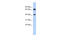 Far Upstream Element Binding Protein 3 antibody, 26-610, ProSci, Western Blot image 
