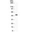 Adrenoceptor Beta 2 antibody, R31906, NSJ Bioreagents, Western Blot image 