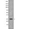 Regulator Of G Protein Signaling 19 antibody, abx218276, Abbexa, Western Blot image 