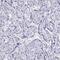 Chloride Intracellular Channel 6 antibody, PA5-63068, Invitrogen Antibodies, Immunohistochemistry frozen image 