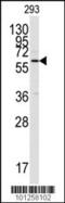 Calcium/Calmodulin Dependent Protein Kinase II Alpha antibody, 62-732, ProSci, Western Blot image 