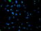 Phosphoglycerate Mutase 2 antibody, LS-C173237, Lifespan Biosciences, Immunofluorescence image 