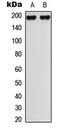 Mitogen-Activated Protein Kinase Kinase Kinase 1 antibody, abx121515, Abbexa, Western Blot image 