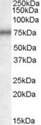 Bridging Integrator 3 antibody, EB08236, Everest Biotech, Western Blot image 