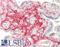Ectonucleotide Pyrophosphatase/Phosphodiesterase 1 antibody, LS-C181346, Lifespan Biosciences, Immunohistochemistry paraffin image 