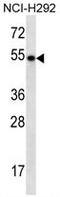 TBC1 Domain Family Member 3F antibody, AP54171PU-N, Origene, Western Blot image 