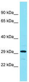 ADP-Ribosylhydrolase Like 1 antibody, TA333338, Origene, Western Blot image 
