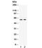 Matrix Metallopeptidase 8 antibody, R32022, NSJ Bioreagents, Western Blot image 