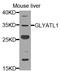 Glycine-N-Acyltransferase Like 1 antibody, A15722, Boster Biological Technology, Western Blot image 