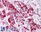 Perilipin 3 antibody, LS-C141356, Lifespan Biosciences, Immunohistochemistry paraffin image 