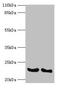 Interferon Alpha 14 antibody, LS-C317778, Lifespan Biosciences, Western Blot image 