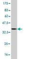 Midline 1 antibody, H00004281-M06, Novus Biologicals, Western Blot image 