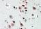 NOVA Alternative Splicing Regulator 1 antibody, PA5-18895, Invitrogen Antibodies, Immunohistochemistry paraffin image 