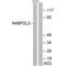 NEDD4 Binding Protein 2 Like 2 antibody, A14016, Boster Biological Technology, Western Blot image 