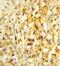 NK3 Homeobox 1 antibody, GTX80628, GeneTex, Immunohistochemistry paraffin image 