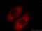 Scinderin antibody, 11579-1-AP, Proteintech Group, Immunofluorescence image 