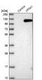 VPS41 Subunit Of HOPS Complex antibody, NBP1-81640, Novus Biologicals, Western Blot image 