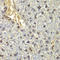 Ribosomal Protein L5 antibody, LS-C331799, Lifespan Biosciences, Immunohistochemistry paraffin image 