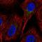 Solute Carrier Family 2 Member 2 antibody, NBP2-49410, Novus Biologicals, Immunofluorescence image 