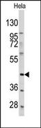 Platelet Derived Growth Factor Receptor Like antibody, AP14407PU-N, Origene, Western Blot image 