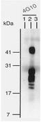 Heparin Binding EGF Like Growth Factor antibody, GTX00702, GeneTex, Immunoprecipitation image 