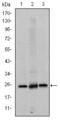 Eukaryotic Translation Initiation Factor 4E antibody, GTX60420, GeneTex, Western Blot image 