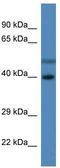 Hydroxysteroid Dehydrogenase Like 1 antibody, TA343009, Origene, Western Blot image 