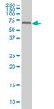 FGR Proto-Oncogene, Src Family Tyrosine Kinase antibody, LS-C133192, Lifespan Biosciences, Western Blot image 