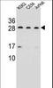 CD79a antibody, LS-C168564, Lifespan Biosciences, Western Blot image 