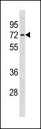 Solute Carrier Family 7 Member 4 antibody, LS-C203843, Lifespan Biosciences, Western Blot image 