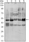 SMAD Family Member 3 antibody, MA5-15663, Invitrogen Antibodies, Western Blot image 