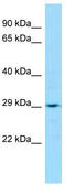 Leucine Rich Repeat Containing 59 antibody, TA331048, Origene, Western Blot image 