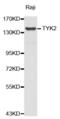 Tyrosine Kinase 2 antibody, abx001740, Abbexa, Western Blot image 