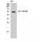 Transforming Growth Factor Beta 1 Induced Transcript 1 antibody, LS-C383913, Lifespan Biosciences, Western Blot image 