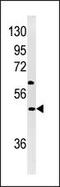 NP-I antibody, 62-784, ProSci, Western Blot image 