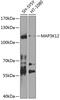 Mitogen-Activated Protein Kinase Kinase Kinase 12 antibody, 23-601, ProSci, Western Blot image 