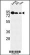 Nucleolar Protein 9 antibody, 64-183, ProSci, Western Blot image 