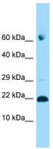 Adenosine Deaminase TRNA Specific 2 antibody, TA331368, Origene, Western Blot image 