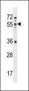 Mex-3 RNA Binding Family Member B antibody, LS-C164158, Lifespan Biosciences, Western Blot image 
