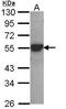 Cytochrome P450 Family 2 Subfamily D Member 6 antibody, LS-C109528, Lifespan Biosciences, Western Blot image 