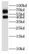 Purinergic Receptor P2Y1 antibody, FNab06072, FineTest, Western Blot image 