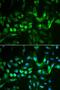 TIMP Metallopeptidase Inhibitor 2 antibody, LS-C331538, Lifespan Biosciences, Immunofluorescence image 