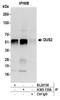 Dihydrouridine Synthase 2 antibody, A305-135A, Bethyl Labs, Immunoprecipitation image 