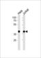 Nucleophosmin 1 antibody, 61-535, ProSci, Western Blot image 